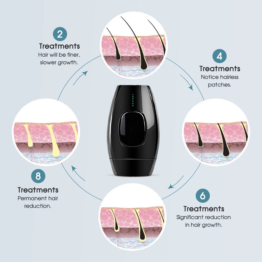 At-Home Depilator IPL Hair Removal Devices 500,000 Flashes Detachable Head Permanent Laser Epilator for Women on Bikinis