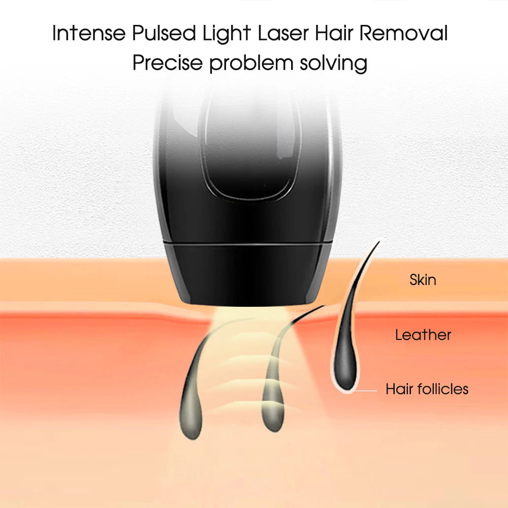 At-Home Depilator IPL Hair Removal Devices 500,000 Flashes Detachable Head Permanent Laser Epilator for Women on Bikinis